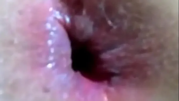Watch Its To Big Extreme Anal Sex With 8inchs Of Hard Dick Stretchs Ass power Movies